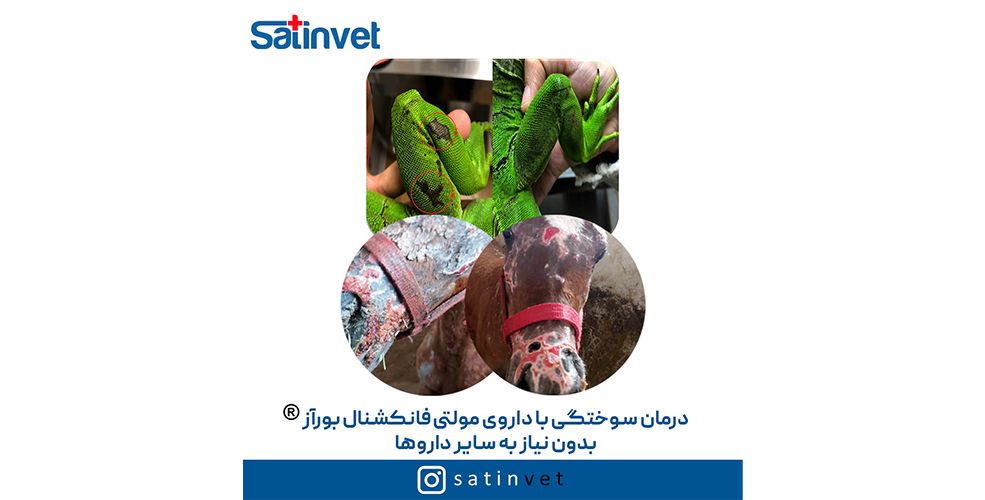 سوختگی بورآز 